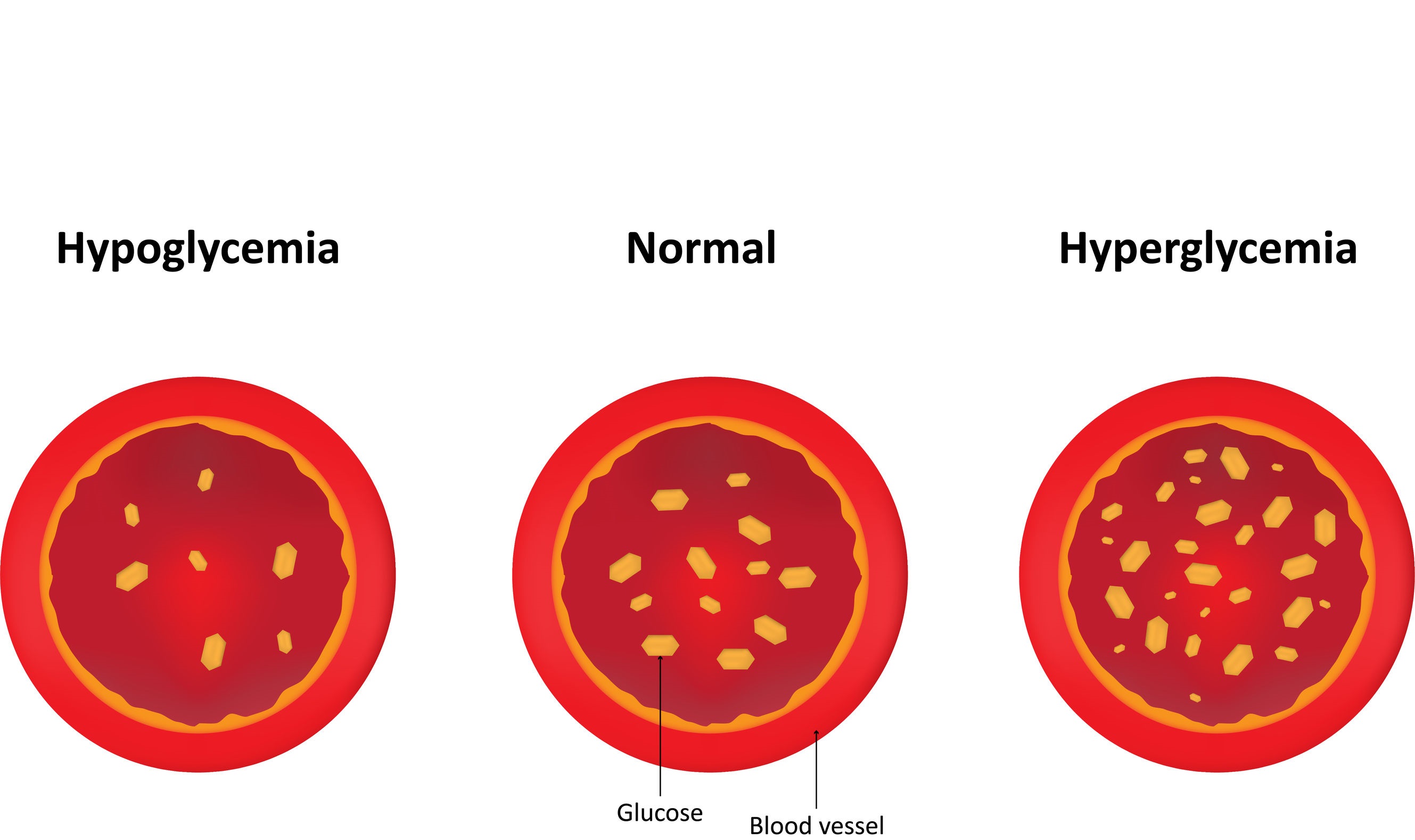Scopri dove indirizzare il glucosio